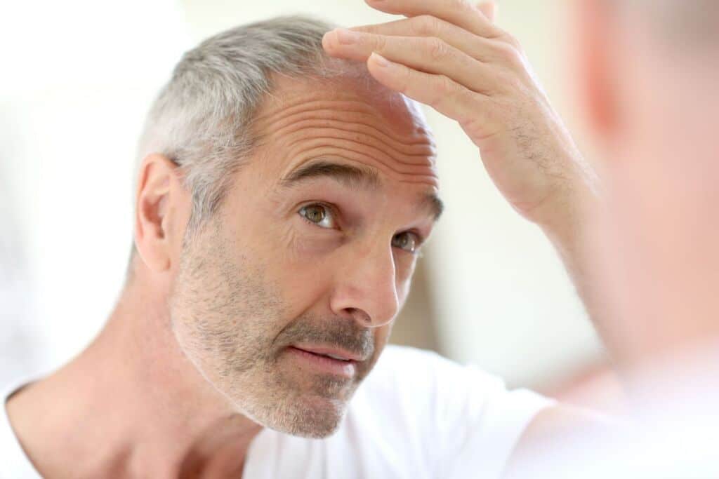Advanced Hair Replacement