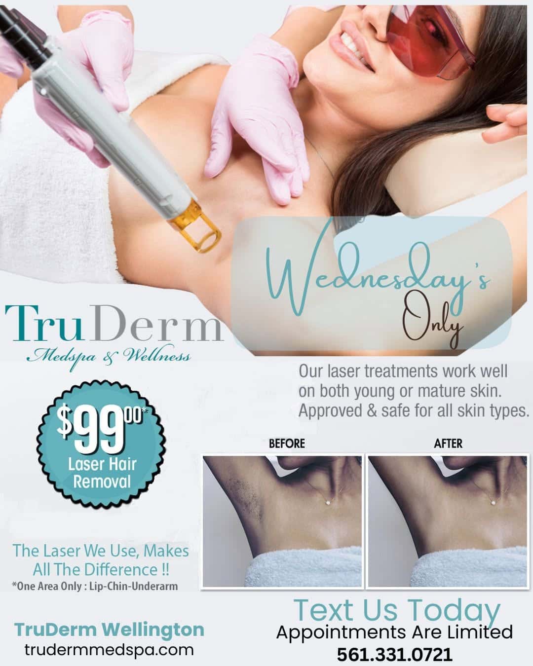 $99 Laser Hair Removal Special in Wellington