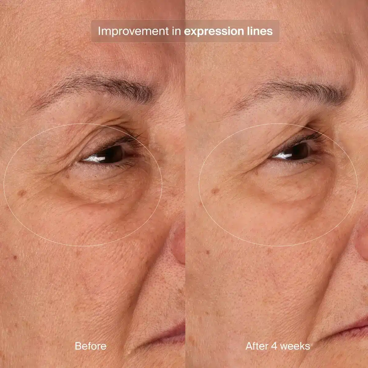 Pavise Bioadaptive Stress Repair Before After