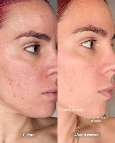 dynamic-age-defense before and after