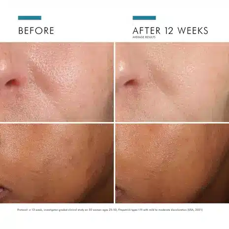 Phloretin CF with Ferulic Acid Gallery 6