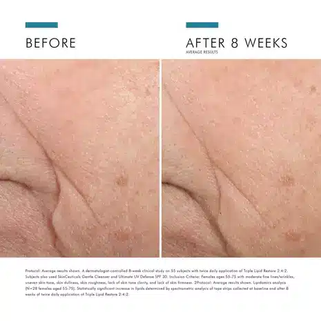 Triple Lipid Restore gallery 9